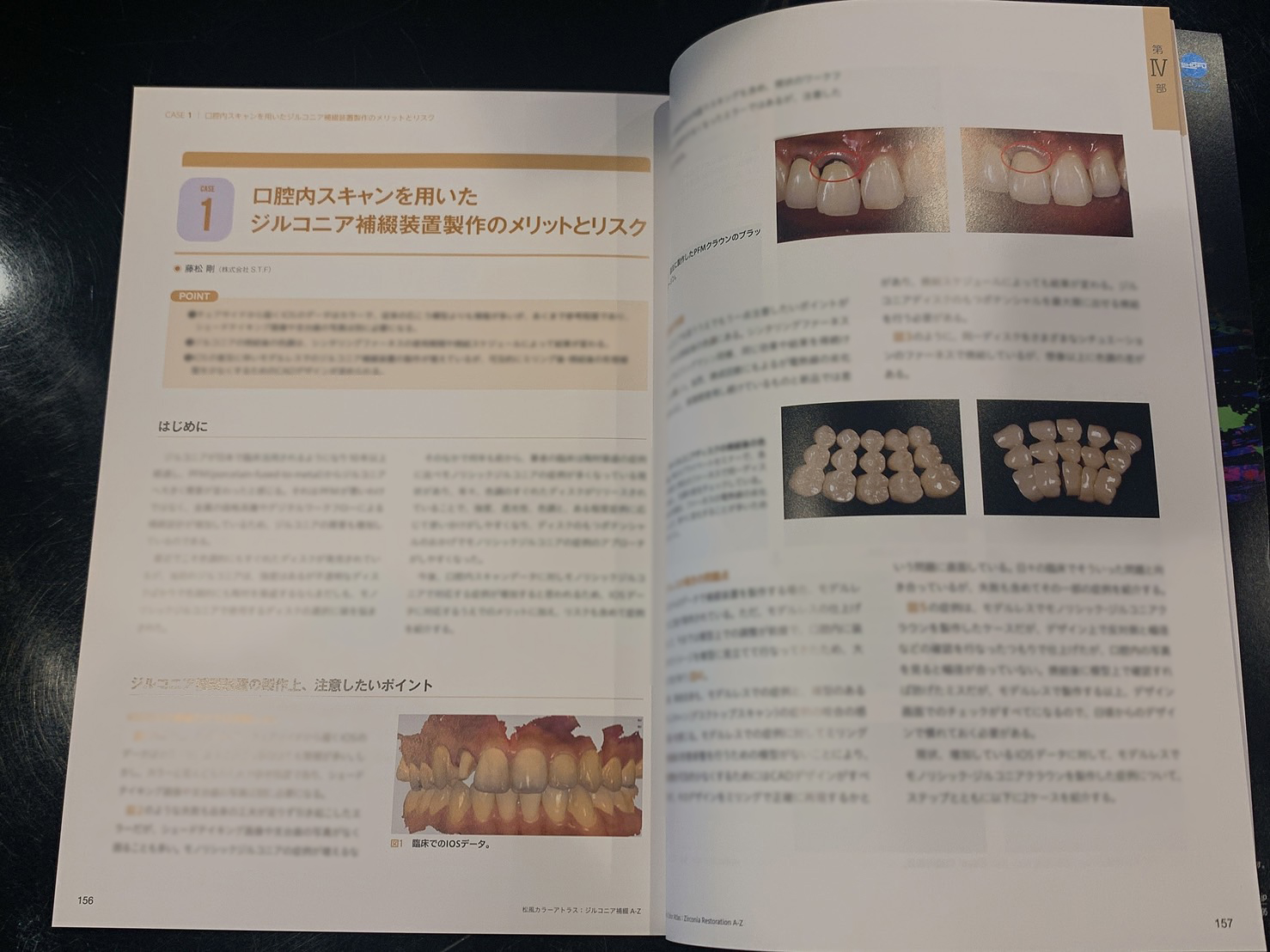 COLOR ATLAS No,51 ジルコニア補綴A-Zに掲載されました。 – 株式会社S